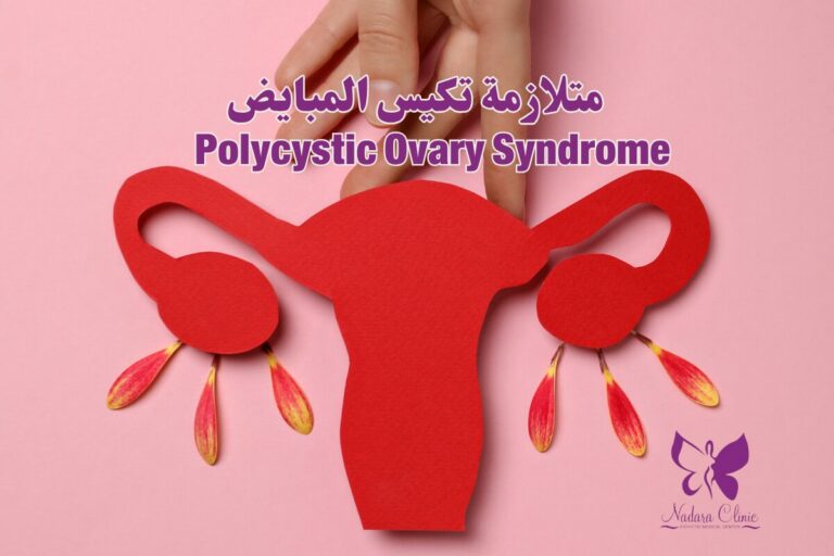 متلازمة تكيس المبايض في الغردقة